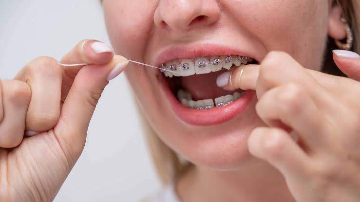 Logo Flossing Gigi 